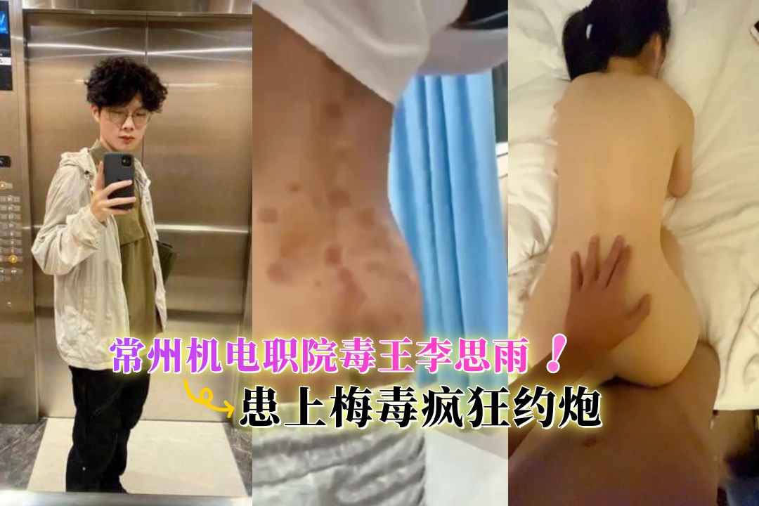 常州机电职院毒王李思雨 患上梅毒疯狂约炮 一个宿舍的男生齐刷刷中招